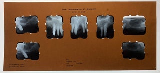 Item #989 Dental Records plus X-Rays for Argentinian President Juan Domingo Peron--Suffering from...